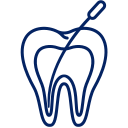 Root Canal Treatment
